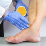 Seven Warning Signs of Clogged Arteries5 Signs You Have Clogged Arteries