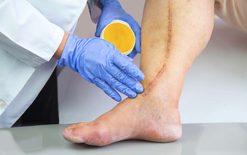 Seven Warning Signs of Clogged Arteries Seven Warning Signs of Clogged Arteries5 Signs You Have Clogged Arteries