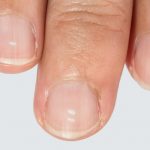 7 Ways Your Nails Can Alert You To Severe Health Issues