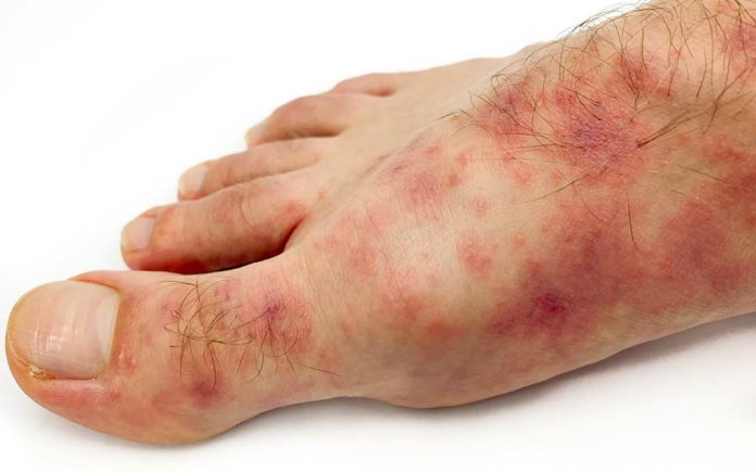 Beware-of-These-New-Coronavirus-Symptoms Beware of These New Coronavirus Symptoms