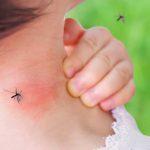 Mosquitos-How-to-Make-Them-Buzz-Off-2