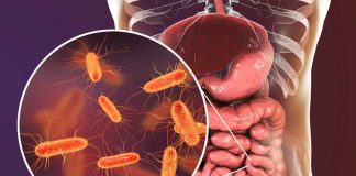 4 Ways To Optimize Probiotic Effectiveness