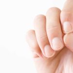 What Your Nails Say about Your Health
