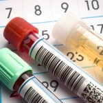 Lab Tests Everyone Over 40 Should Get Lab Results Everyone Over 50 Should Have